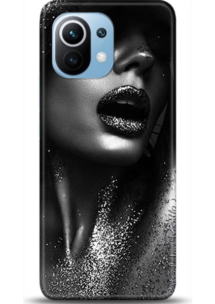 Xiaomi Mi 11 Kılıf Hd Baskılı Kılıf - Followed Institution 0338