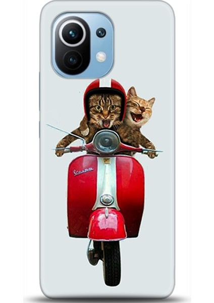 Xiaomi Mi 11 Kılıf Hd Baskılı Kılıf - Followed Institution 0357