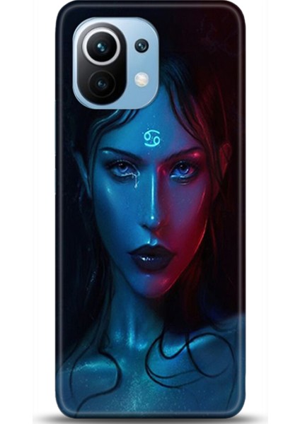 Xiaomi Mi 11 Kılıf Hd Baskılı Kılıf - Followed Institution 0388