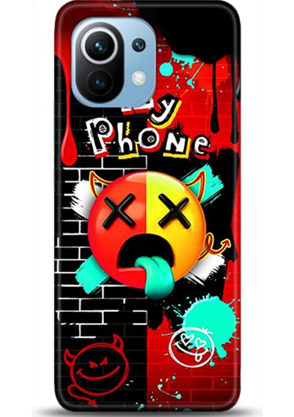 Xiaomi Mi 11 Kılıf Hd Baskılı Kılıf - Followed Institution 0683