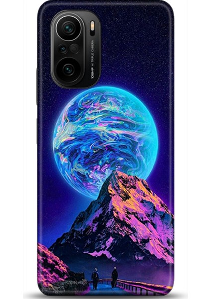 Xiaomi Mi 11i Kılıf Hd Baskılı Kılıf - Followed Institution 0052