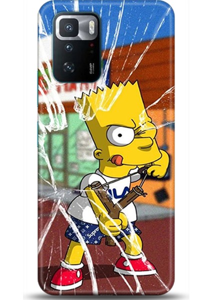 Xiaomi Poco X3 Gt Kılıf Hd Baskılı Kılıf - Followed Institution 0279