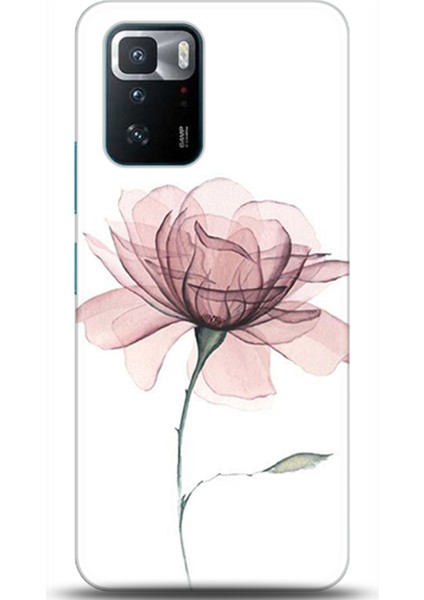 Xiaomi Poco X3 Gt Kılıf Hd Baskılı Kılıf - Followed Institution 0309