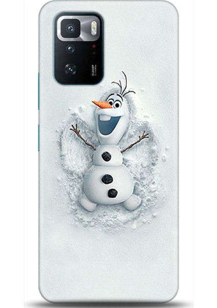 Xiaomi Poco X3 Gt Kılıf Hd Baskılı Kılıf - Followed Institution 0368