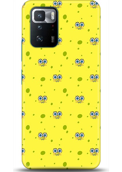 Xiaomi Poco X3 Gt Kılıf Hd Baskılı Kılıf - Followed Institution 0567