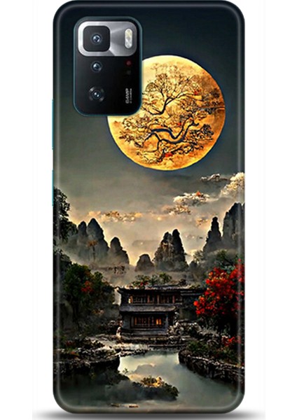 Xiaomi Poco X3 Gt Kılıf Hd Baskılı Kılıf - Followed Institution 0411
