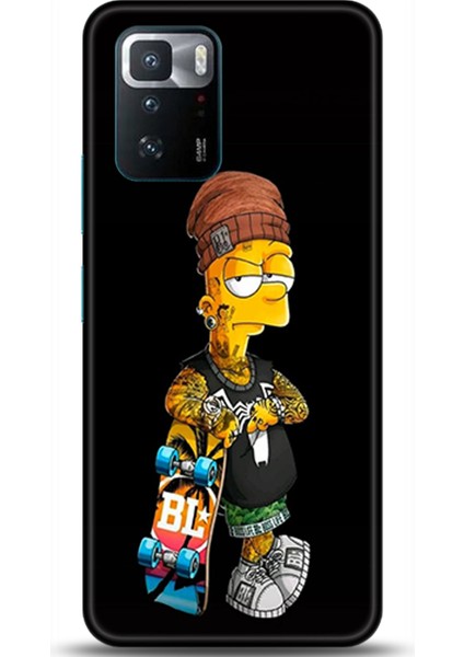 Xiaomi Poco X3 Gt Kılıf Hd Baskılı Kılıf - Followed Institution 0527