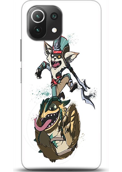 Xiaomi Mi 11 Lite Kılıf Hd Baskılı Kılıf - Followed Institution 0235