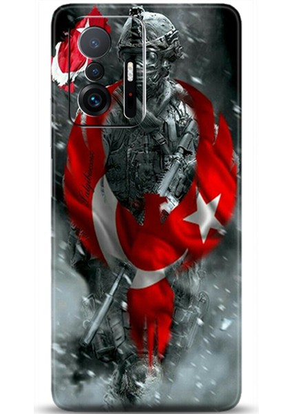 Xiaomi Mi 11T Kılıf Hd Baskılı Kılıf - Followed Institution 0231