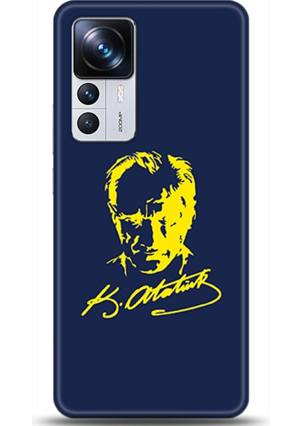 Xiaomi Mi 12T Pro Kılıf Hd Baskılı Kılıf - Followed Institution 0548