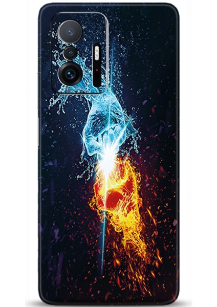 Xiaomi Mi 11T Kılıf Hd Baskılı Kılıf - Followed Institution 0366