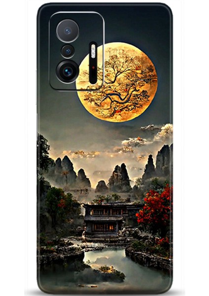 Xiaomi Mi 11T Kılıf Hd Baskılı Kılıf - Followed Institution 0411