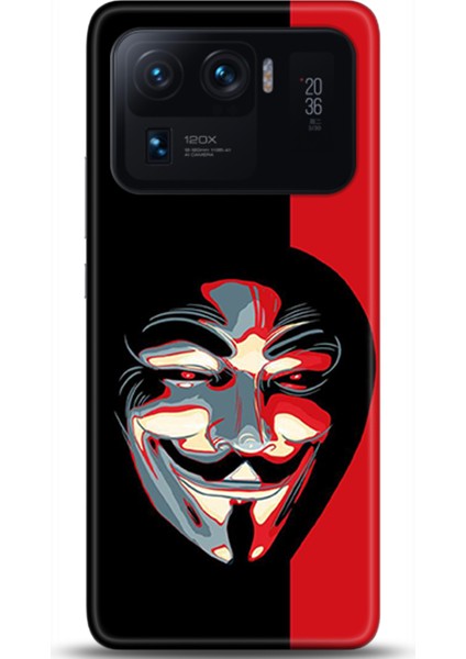 Xiaomi Mi 11 Ultra Kılıf Hd Baskılı Kılıf - Followed Institution 0492