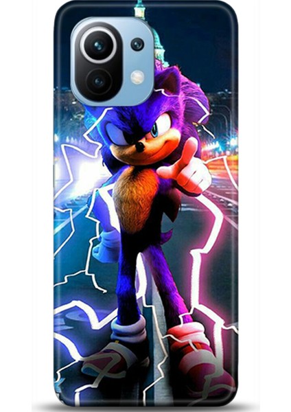 Xiaomi Mi 11 Kılıf Hd Baskılı Kılıf - Followed Institution 0166