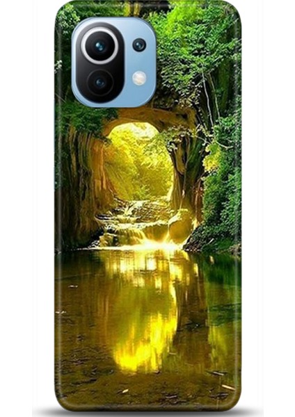 Xiaomi Mi 11 Kılıf Hd Baskılı Kılıf - Followed Institution 0179
