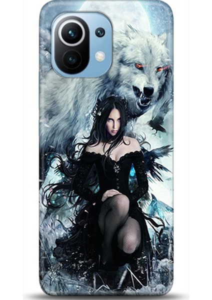 Xiaomi Mi 11 Kılıf Hd Baskılı Kılıf - Followed Institution 0322