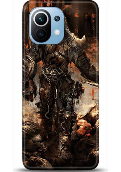 Xiaomi Mi 11 Kılıf Hd Baskılı Kılıf - Followed Institution 0329