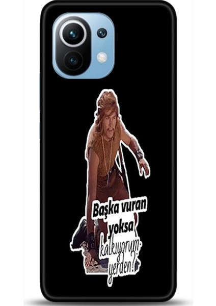 Xiaomi Mi 11 Kılıf Hd Baskılı Kılıf - Followed Institution 0516