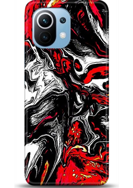 Xiaomi Mi 11 Kılıf Hd Baskılı Kılıf - Followed Institution 0531