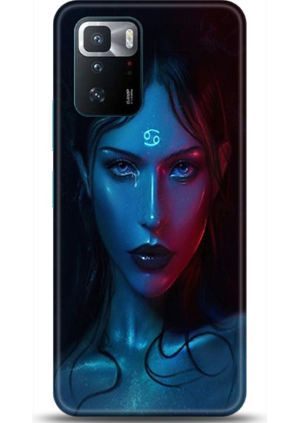 Xiaomi Poco X3 Gt Kılıf Hd Baskılı Kılıf - Followed Institution 0388