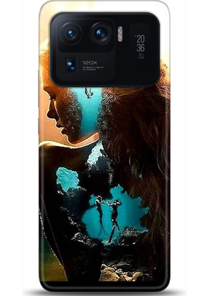 Xiaomi Mi 11 Ultra Kılıf Hd Baskılı Kılıf - Followed Institution 0377