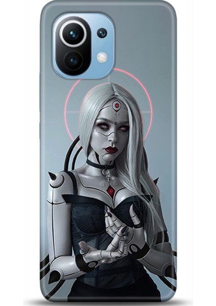 Xiaomi Mi 11 Kılıf Hd Baskılı Kılıf - Followed Institution 0104