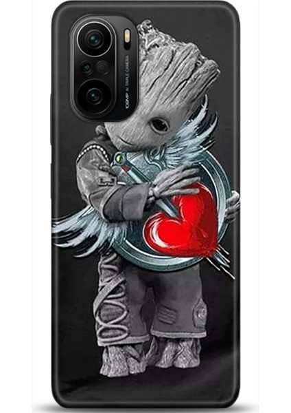 Xiaomi Mi 11i Kılıf Hd Baskılı Kılıf - Followed Institution 0282