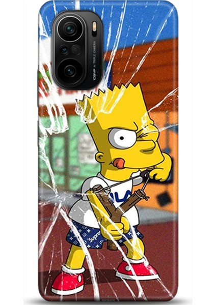 Xiaomi Mi 11i Kılıf Hd Baskılı Kılıf - Followed Institution 0279