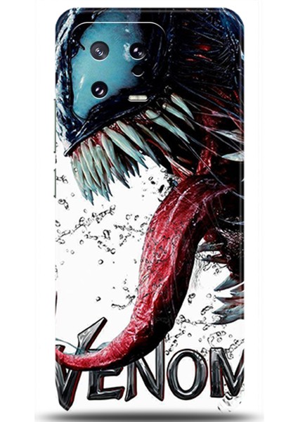 Xiaomi Mi 13 Pro Kılıf Hd Baskılı Kılıf - Followed Institution 0568