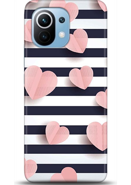 Xiaomi Mi 11 Kılıf Hd Baskılı Kılıf - Followed Institution 0682