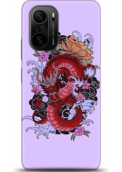 Xiaomi Mi 11i Kılıf Hd Baskılı Kılıf - Followed Institution 0163