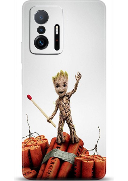 Xiaomi Mi 11T Kılıf Hd Baskılı Kılıf - Followed Institution 0140