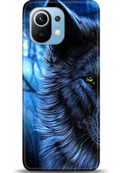 Xiaomi Mi 11 Kılıf Hd Baskılı Kılıf - Followed Institution 0136