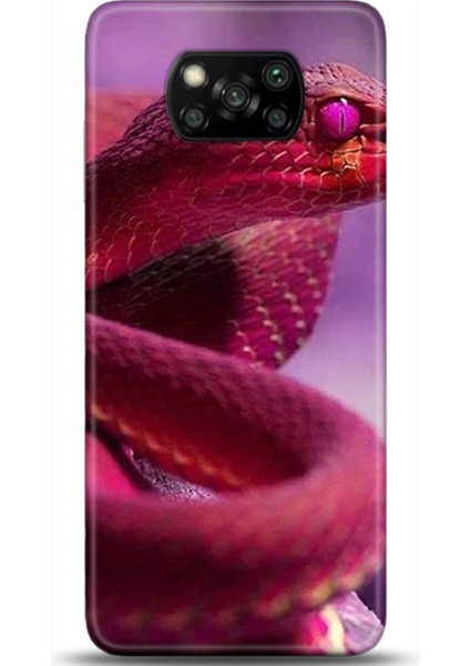 Xiaomi Poco X3 Pro Kılıf Hd Baskılı Kılıf - Followed Institution 0362