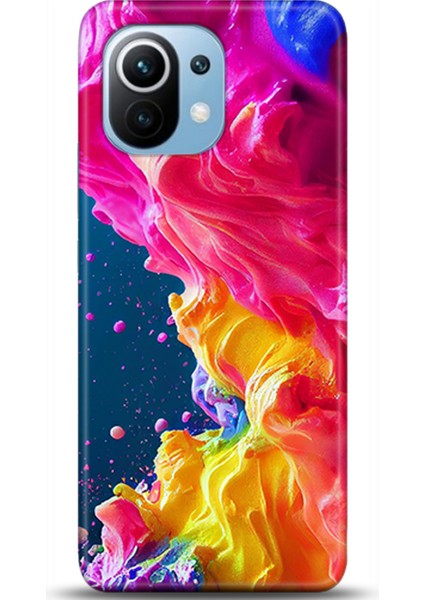 Xiaomi Mi 11 Kılıf Hd Baskılı Kılıf - Followed Institution 0599