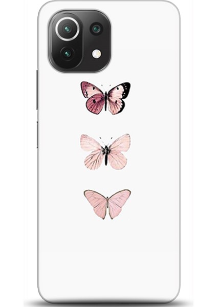 Xiaomi Mi 11 Lite Kılıf Hd Baskılı Kılıf - Followed Institution 0334