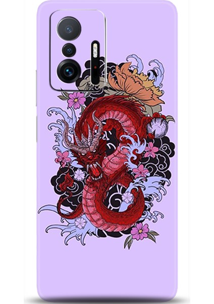 Xiaomi Mi 11T Kılıf Hd Baskılı Kılıf - Followed Institution 0163
