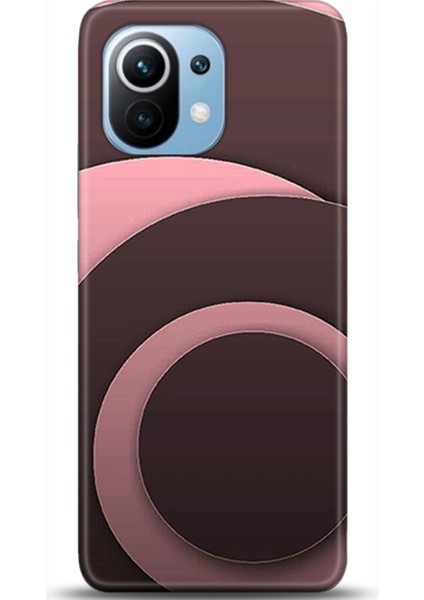 Xiaomi Mi 11 Kılıf Hd Baskılı Kılıf - Followed Institution 0697