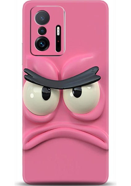 Xiaomi Mi 11T Kılıf Hd Baskılı Kılıf - Followed Institution 0053