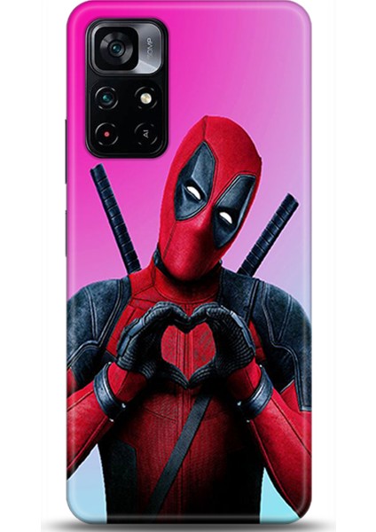 Xiaomi Poco M4 Pro 5g Kılıf Hd Baskılı Kılıf - Followed Institution 0218