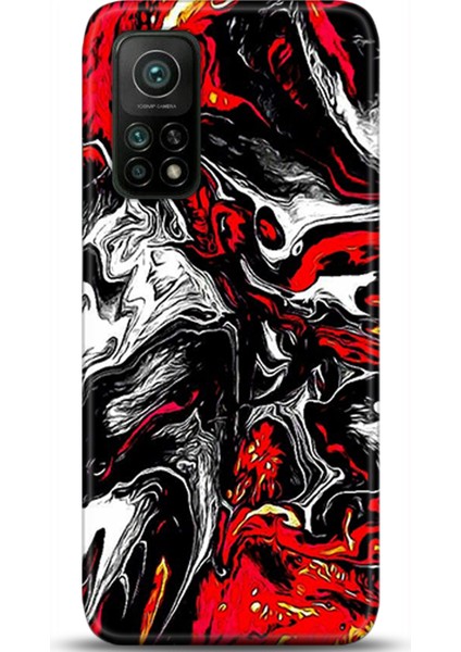 Xiaomi Mi 10T Pro Kılıf Hd Baskılı Kılıf - Followed Institution 0531