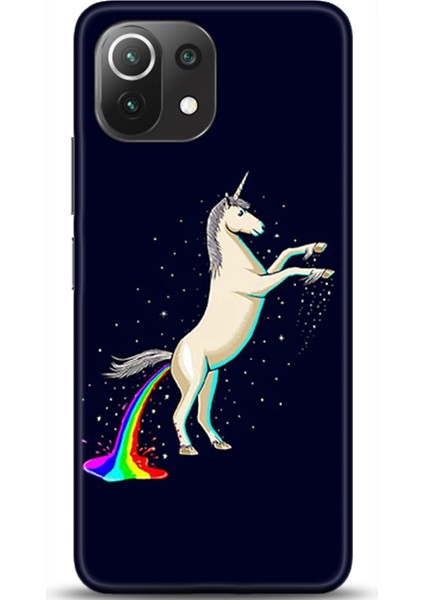 Xiaomi Mi 11 Lite Kılıf Hd Baskılı Kılıf - Followed Institution 0556