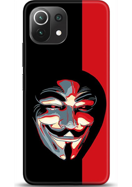 Xiaomi Mi 11 Lite Kılıf Hd Baskılı Kılıf - Followed Institution 0492