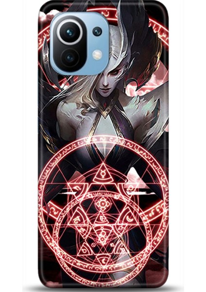 Xiaomi Mi 11 Kılıf Hd Baskılı Kılıf - Followed Institution 0192