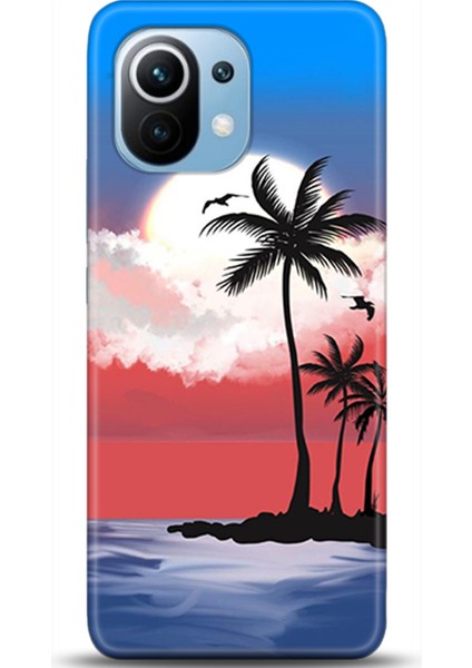 Xiaomi Mi 11 Kılıf Hd Baskılı Kılıf - Followed Institution 0589
