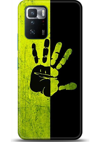 Xiaomi Poco X3 Gt Kılıf Hd Baskılı Kılıf - Followed Institution 0648