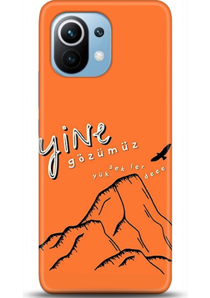 Xiaomi Mi 11 Kılıf Hd Baskılı Kılıf - Followed Institution 0422