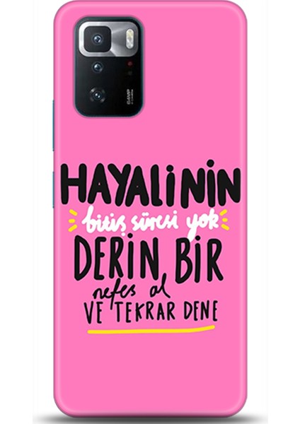 Xiaomi Poco X3 Gt Kılıf Hd Baskılı Kılıf - Followed Institution 0423
