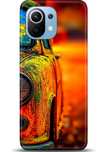 Xiaomi Mi 11 Kılıf Hd Baskılı Kılıf - Followed Institution 0613