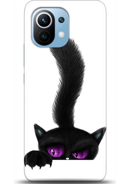 Xiaomi Mi 11 Kılıf Hd Baskılı Kılıf - Followed Institution 0646